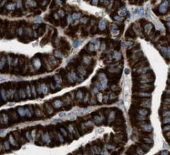 ACAA1 Rabbit Polyclonal Antibody