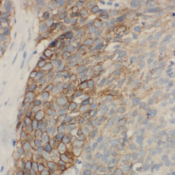 ACAA2 Rabbit Polyclonal Antibody