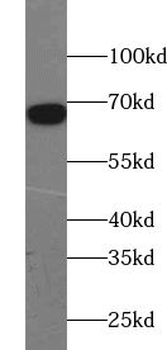 ACAD9 Rabbit Polyclonal Antibody