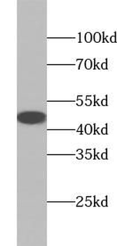 ACADM Antibody