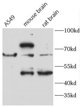 ACADVL Rabbit Polyclonal Antibody