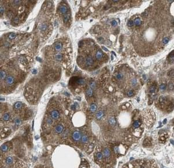 ACADVL Rabbit Polyclonal Antibody