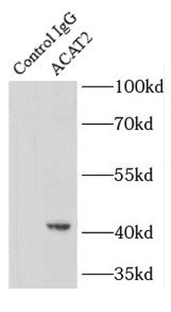 ACAT2 Rabbit Polyclonal Antibody