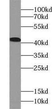 ACAT2 Rabbit Polyclonal Antibody
