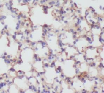 ACAT2 Rabbit Polyclonal Antibody