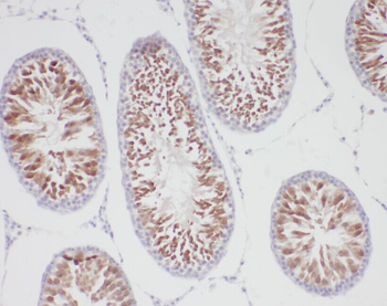 ACBD3 Rabbit Polyclonal Antibody