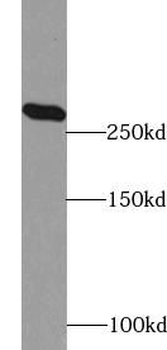 ACACA Rabbit Polyclonal Antibody