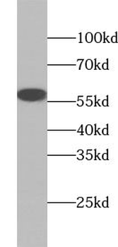 ACD Antibody