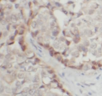 TNK2 Rabbit Polyclonal Antibody