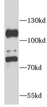 ACO1 Antibody