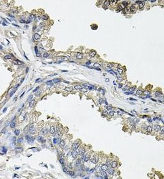 ACO1 Antibody