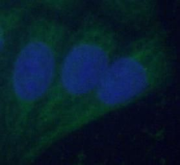 ACO2 Rabbit Polyclonal Antibody