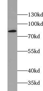 ACO2 Rabbit Polyclonal Antibody