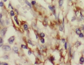 ACO2 Rabbit Polyclonal Antibody