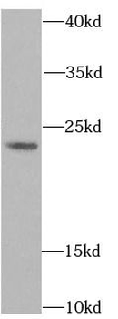 ACP1 Rabbit Polyclonal Antibody