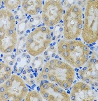 ACP1 Rabbit Polyclonal Antibody