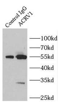 ACRV1 Rabbit Polyclonal Antibody