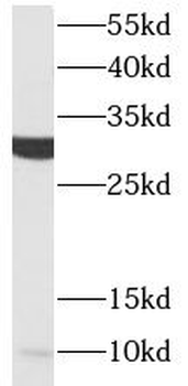 ACRV1 Rabbit Polyclonal Antibody