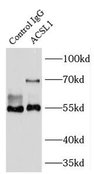 ACSL1 Rabbit Polyclonal Antibody
