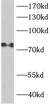 ACSL1 Rabbit Polyclonal Antibody
