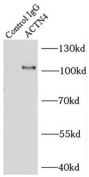 ACTN4 Antibody