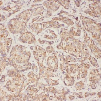 ACTN4 Antibody