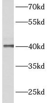 ACTRT2 Rabbit Polyclonal Antibody