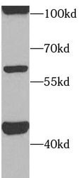 ACVR1C Rabbit Polyclonal Antibody