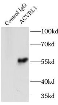 ACVRL1 Antibody
