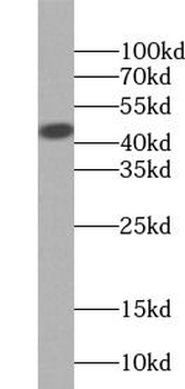 ADA Antibody