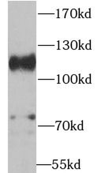 ADAM17 Antibody