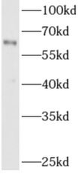 ADAM8 Rabbit Polyclonal Antibody