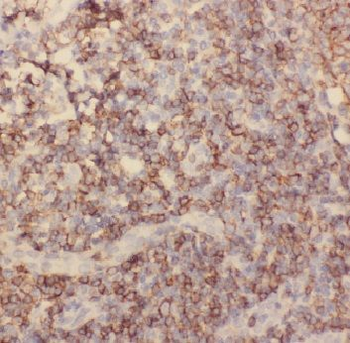 ADAM8 Rabbit Polyclonal Antibody