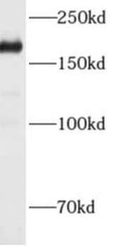 ADAMTS12 Rabbit Polyclonal Antibody