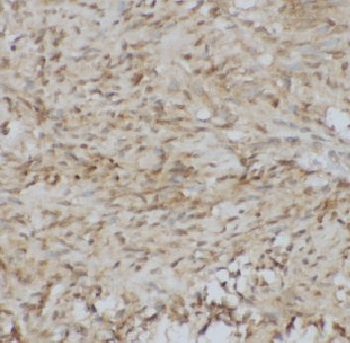 ADAMTS12 Rabbit Polyclonal Antibody