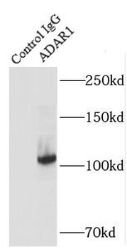 ADAR Antibody