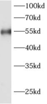 ADAT1 Rabbit Polyclonal Antibody