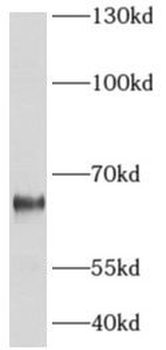 ADCK5 Rabbit Polyclonal Antibody