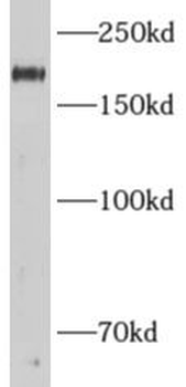 ADCY3 Rabbit Polyclonal Antibody