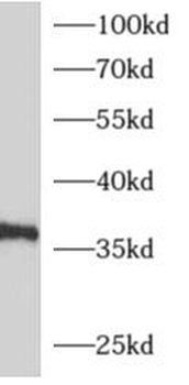 ADORA1 Rabbit Polyclonal Antibody