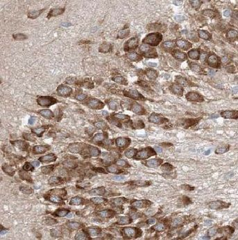 ADORA1 Rabbit Polyclonal Antibody