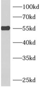 ADSL Rabbit Polyclonal Antibody