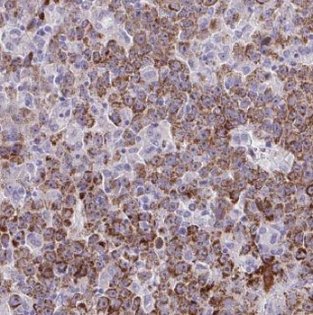 ADSL Rabbit Polyclonal Antibody