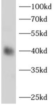 ADH1B Rabbit Polyclonal Antibody