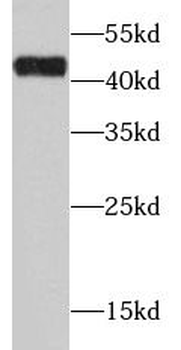 ADH1C Rabbit Polyclonal Antibody