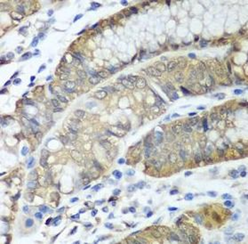 ADH1C Rabbit Polyclonal Antibody