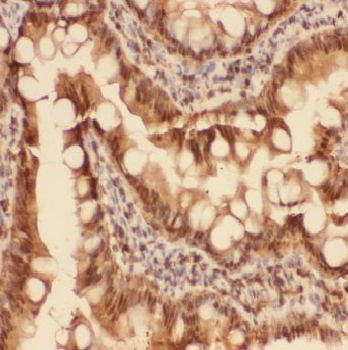 ADI1 Rabbit Polyclonal Antibody
