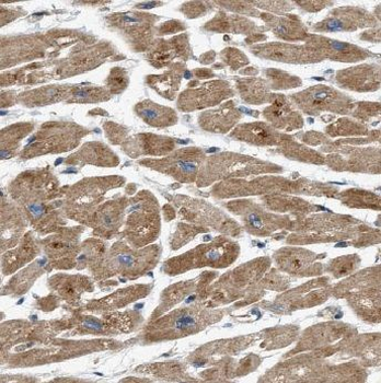 ADM2 Rabbit Polyclonal Antibody