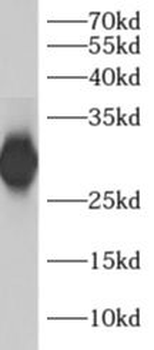 ADO Rabbit Polyclonal Antibody