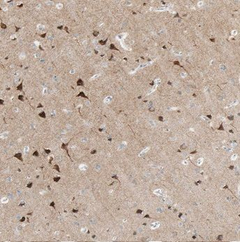 ADO Rabbit Polyclonal Antibody